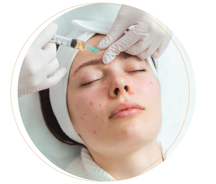 Benefits of PRP treatment in Malaysia: Improve skin condition, i.e. blemishes, acne and scars