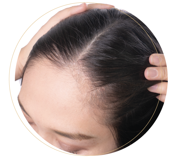 Hair Loss Treatment Malaysia