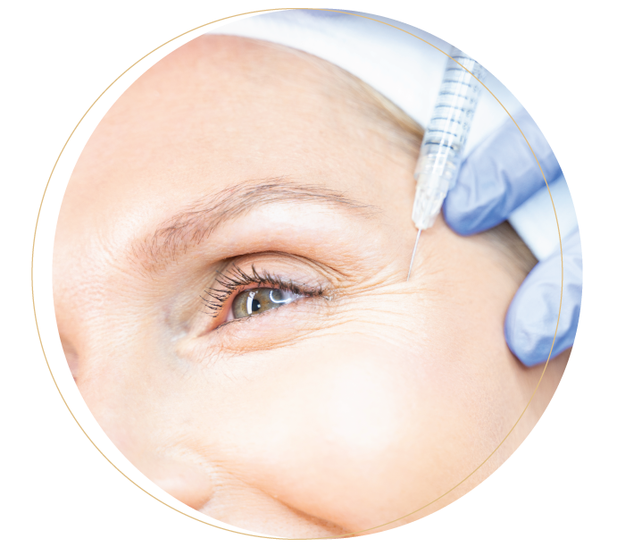 Benefits of PRP treatment in Malaysia: Reduce fine lines and wrinkles