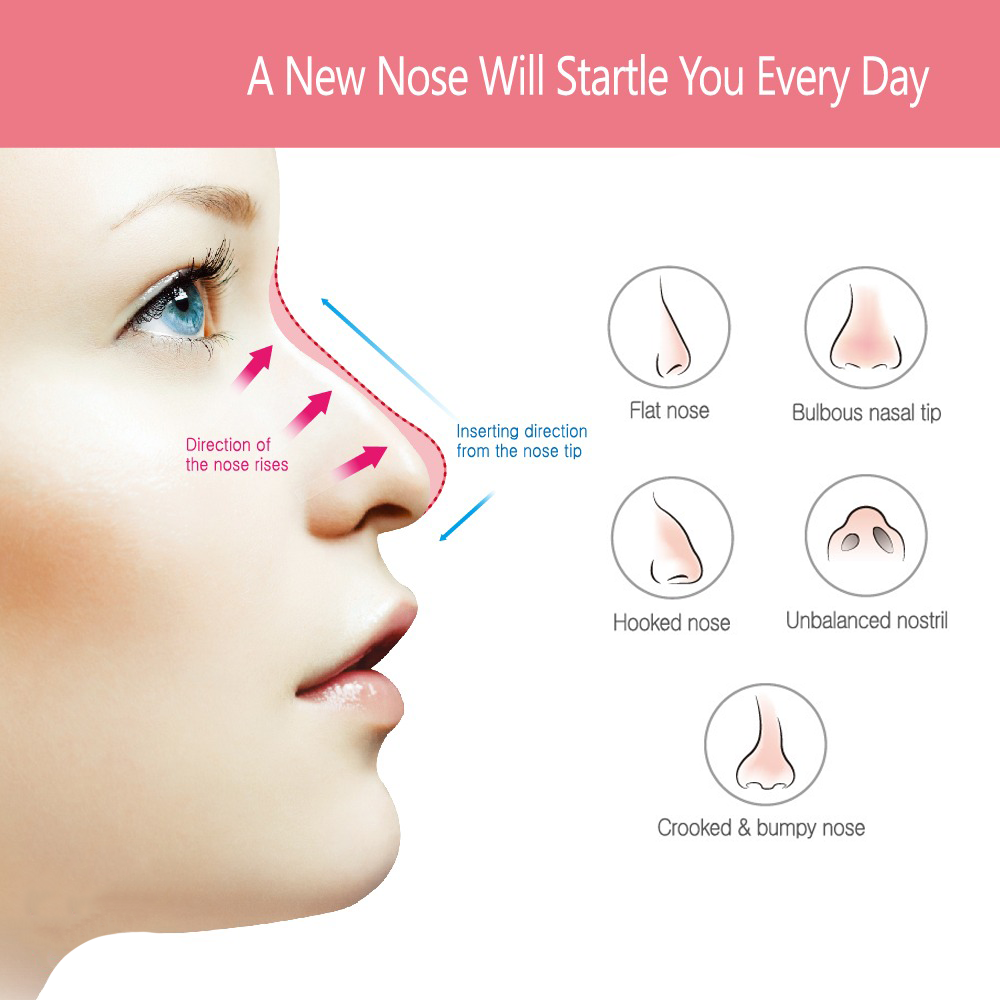 Common Thread Lift Treatment Areas in Malaysia: Nose Thread Lift