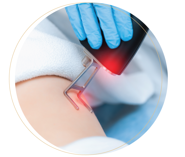 laser scar removal treatment