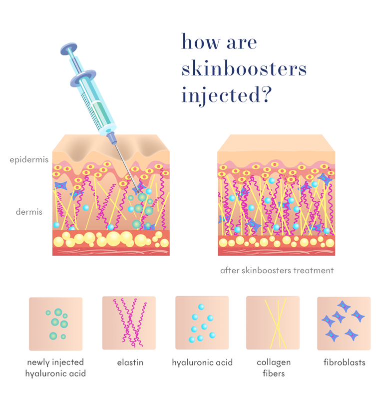 How Do Skin Booster Injections in Malaysia Work?​