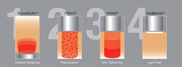 Multi-Dimensional Fotona Laser Therapy in Malaysia for Skin Rejuvenation