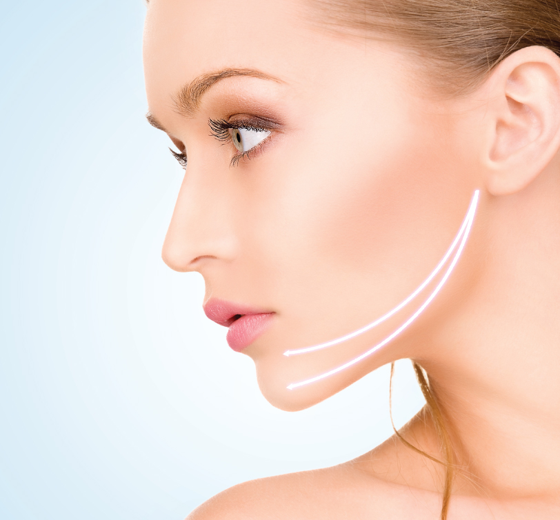 Common Thread Lift Treatment Areas in Malaysia: Jawline or Jowl Thread Lift