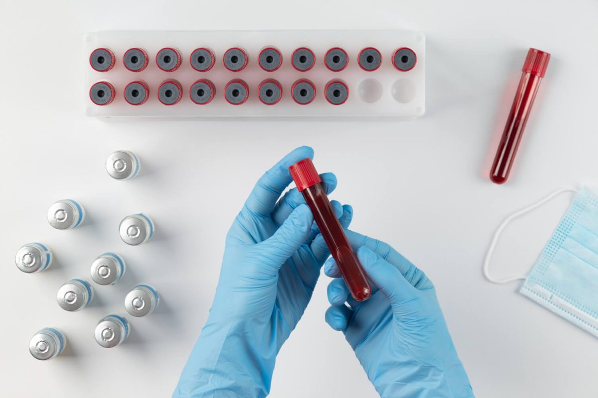 STD Screening Methods: Blood Tests