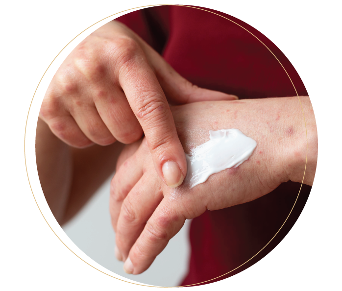 topical-treatment